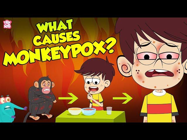 What Causes Monkeypox? | Monkeypox Outbreak 2022 | The Dr Binocs Show | Peekaboo Kidz