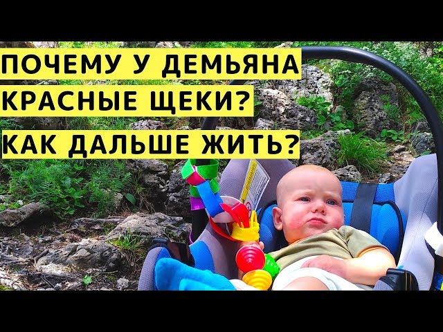 Почему у Демьяна Красные Щеки и Как Дальше с Этим Жить