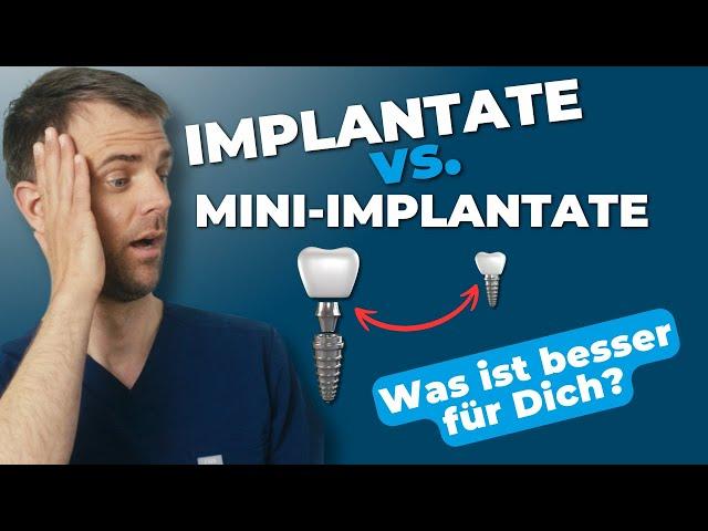 Traditionelle Implantate vs. Mini-Implantate – Was ist besser für dich?