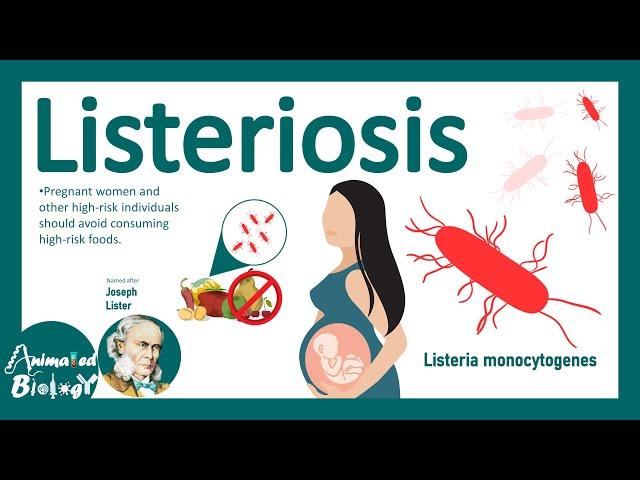Listeriosis (Listeria Monocytogenes) | Sources, Pathophysiology, Symptoms, Diagnosis, Treatment