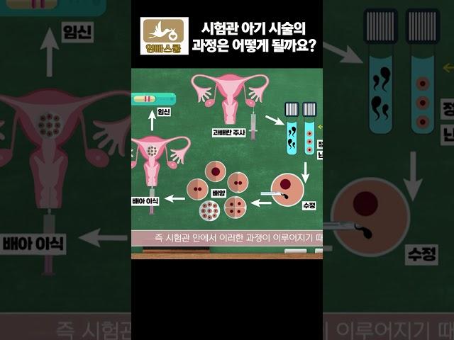 시험관 아기시술의 과정은 어떻게 될까요