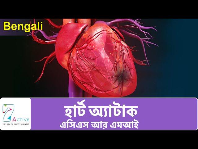 Heart Attack (ACS & MI) | Bengali