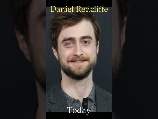 HARRY POTTER Actors Then VS Now...  [PART 1]