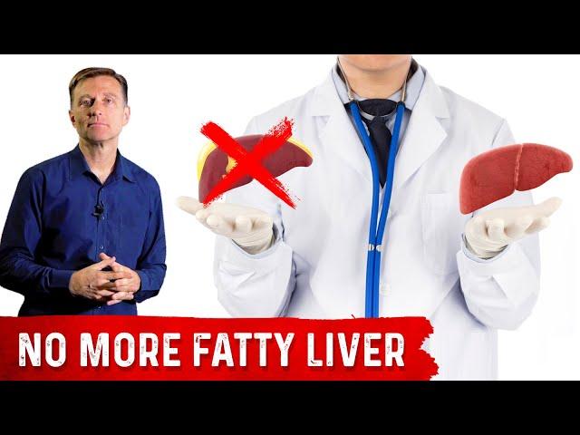 Amazing Fatty Liver Success Story: Dr. Berg