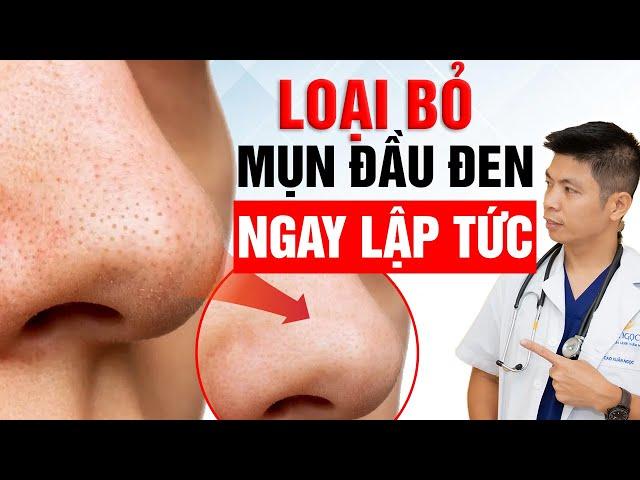 Loại Bỏ Mụn Đầu Đen Ngay Lập Tức Bằng Điều Chỉnh Chế Độ Ăn | Dr Ngọc