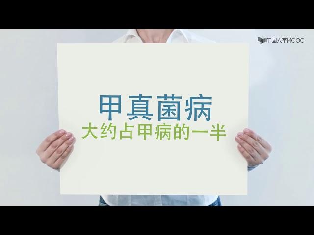 13、2 6 甲真菌病和皮肤黏膜念珠菌病 同济医学院 皮肤性病学