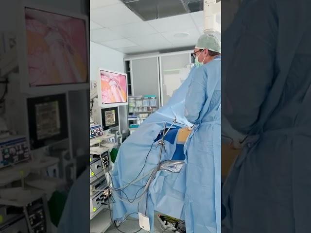 Behind the scenes of a gastric bypass surgery with Prof A Maleckas #bariatric #weightlosssurgery