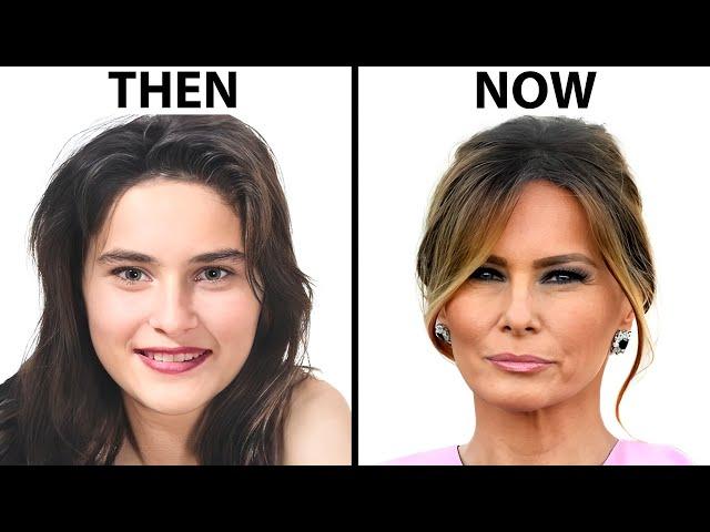 Melania Trump's NEW FACE | Plastic Surgery Analysis