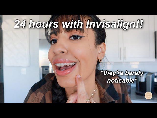 MY FIRST 24 HOURS WITH INVISALIGN 2022 (getting invisalign, what to expect & pain levels)