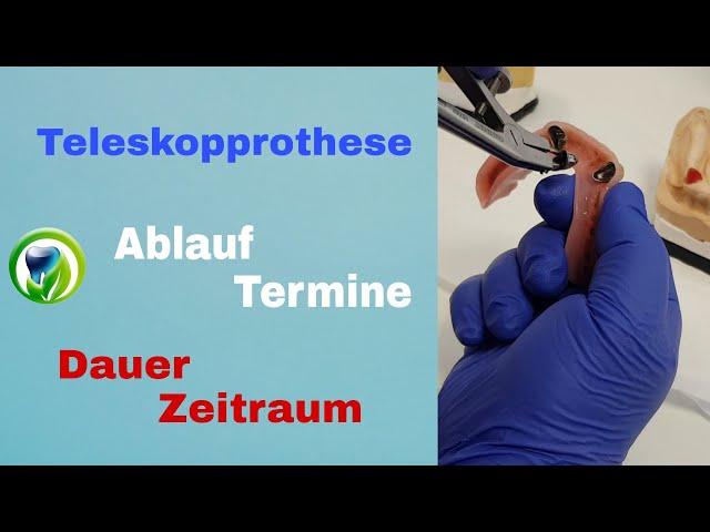 Die Teleskopprothese - Ablauf, Termine, Dauer  und Zeitraum