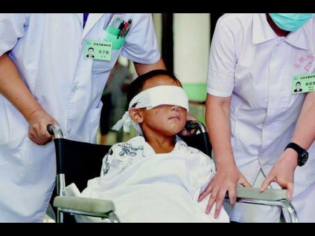 Niño chino recibe ojos artificiales