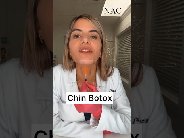 Chin Botox #drbitafarrell #botox #chinbotox