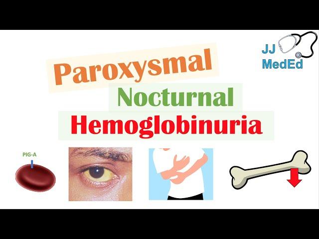 Paroxysmal Nocturnal Hemoglobinuria (PNH) | Causes & Pathogenesis, Symptoms, Diagnosis & Treatment