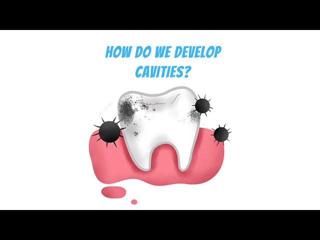 How cavities develops from Tooth decay? (3D animation)