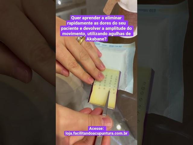 Elimine as dores! #facilitandoacupuntura #medicinachinesa #acupuntura