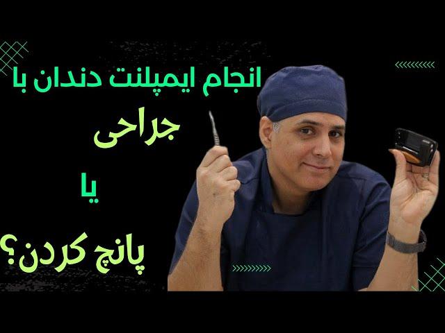 انجام ایمپلنت با تکنیک پانچ لثه یا جراحی؟