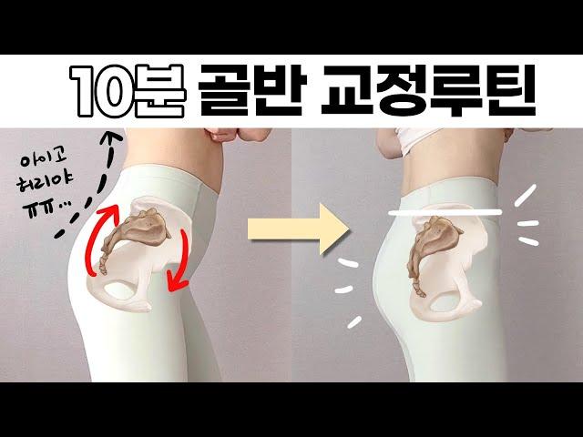 딱 10분! 골반교정 풀루틴, 현대인 80%가 앓는[골반전방경사]에서 벗어나기 l 허리통증, 오리엉덩이