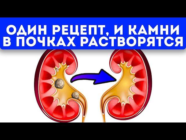 Знахарь поведал, как с помощью 1 овоща без боли растворить камни в почках