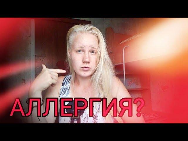 КАК УБРАТЬ АЛЛЕРГИЮ НАВСЕГДА БЕЗ ТАБЛЕТОК?