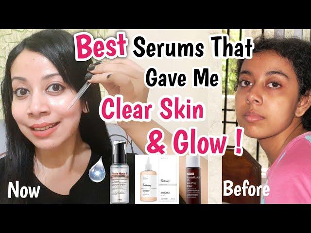 Best Serums That Helped Me Get Clear Skin & Glow!