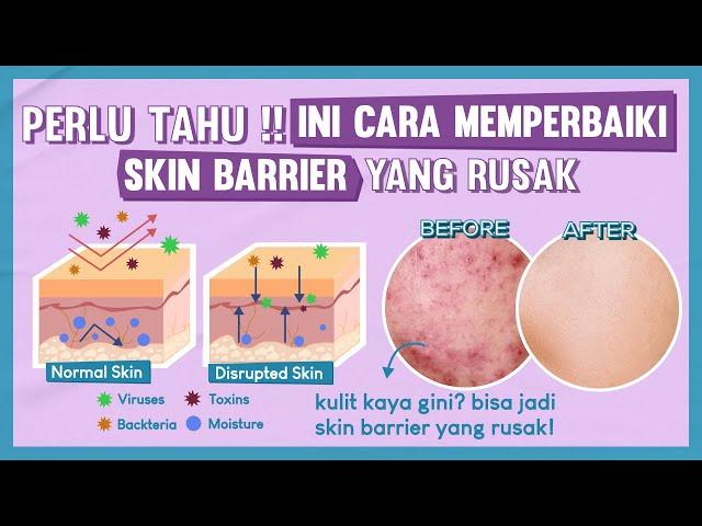 Perlu Tahu! Ini Cara Memperbaiki Skin Barrier Yang Rusak