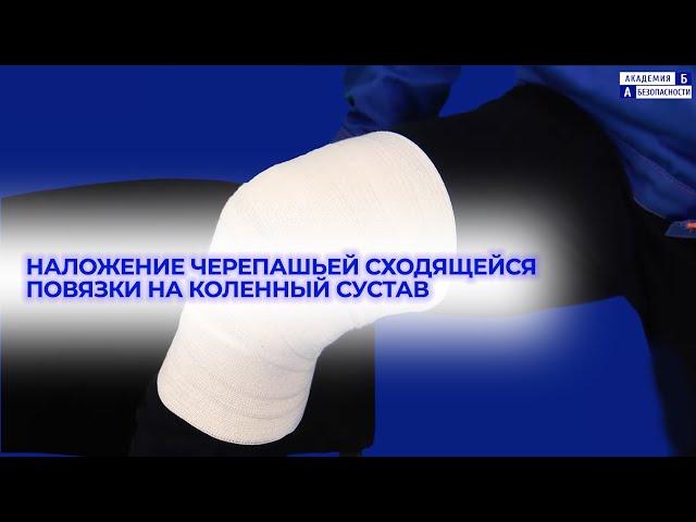 Наложение черепашьей сходящейся повязки на коленный сустав