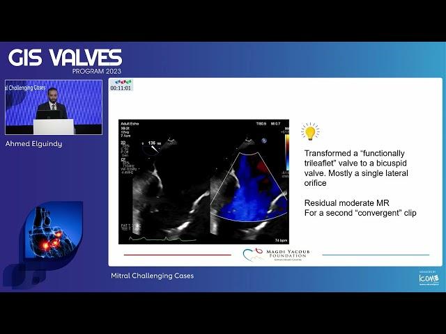 14  Mitral Challenging Cases   Ahmed Elguindy