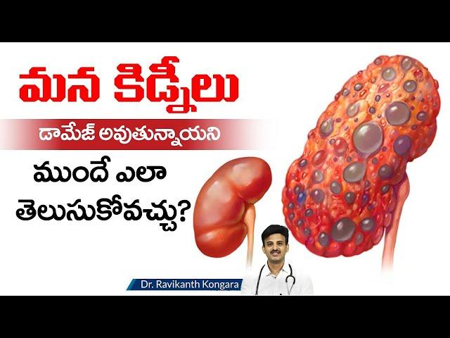 How Diabetes Effect Kidneys | Creatinine Levels | Diabetes Control | Dr. Ravikanth Kongara