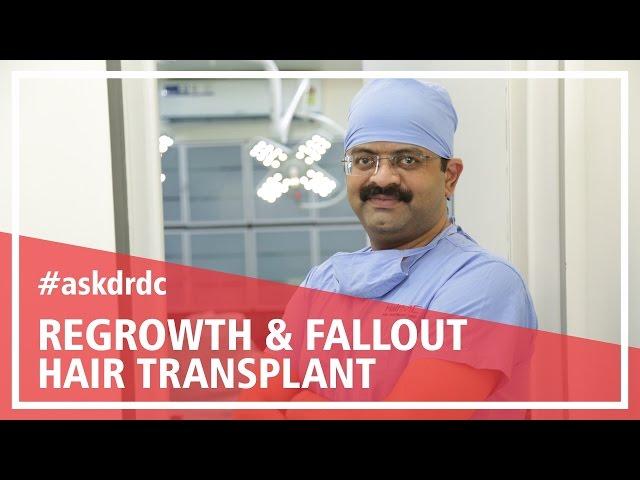 Hair growth after Hair Transplant:Fallout & regrowth of Hair | HairMD, Pune
