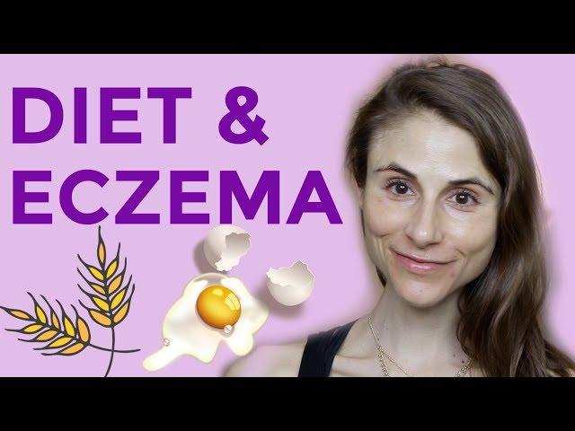 DIET & SUPPLEMENTS FOR ECZEMA: Q&A WITH DERMATOLOGIST DR DRAY