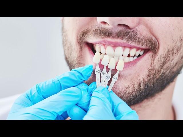 What is a Veneer? | Oakbrook Dental & Orthodontics