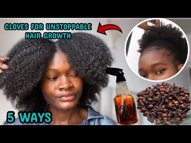 CLOVES FOR MASSIVE HAIR GROWTH | how to use cloves in 5 ways for massive hair growth