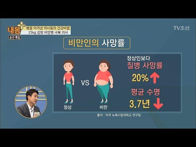 비만은 반드시 치료해야 할 질병이다? [내 몸 플러스] 85회 20171224