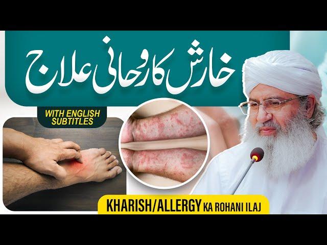 Kharish (Itch) Ka Rohani Ilaj | Kharish Khatam Karne Ka Tariqa | Haji Shahid Attari