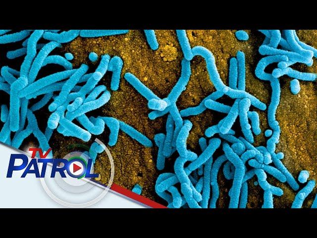 DOH siniguradong tinututukan ang banta ng 'Marburg virus' | TV Patrol