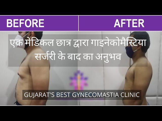 THIS IS THE BEST GYNECOMASTIA TREATMENT CLINIC IN GUJARAT SAYS A 21-YEAR-OLD PATIENT IN HINDI