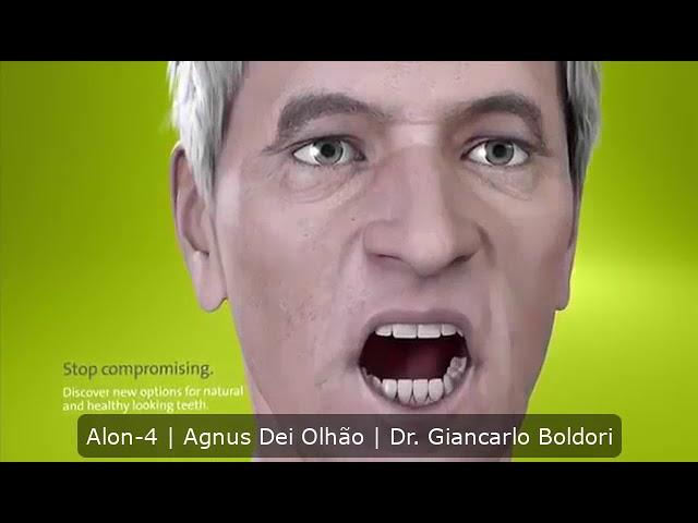 Prótese Fixa / 4 Implantes dentários | All-on-4 | Agnus Dei Olhão | Dr. Giancarlo Boldori