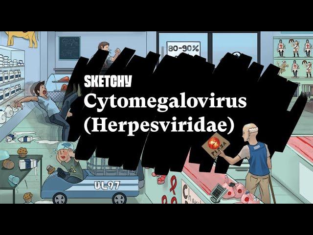 Understanding Cytomegalovirus:Herpes Virus Family Study (Full Lesson)| Sketchy Medical |USMLE Step 1