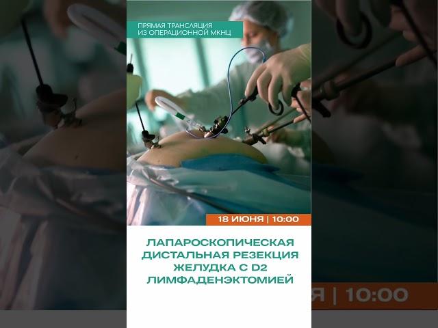 Трансляция из операционной #МКНЦ