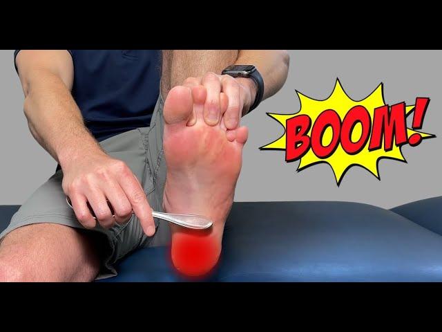 Heel Spur Treatment and Home Remedies: 10 Ways to Easy Fast Relief | Dr Tarik Torki
