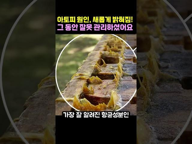 아토피 습진의 가려움증의 원인이 이제서야 밝혀졌습니다.(feat. 아토크네)