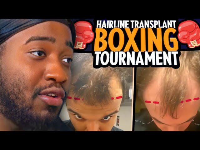 I'm Hosting A Hairline Transplant Boxing Tournament