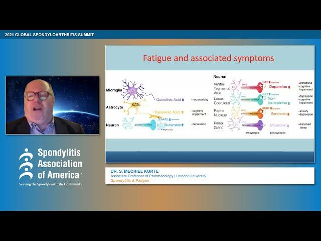 Spondylitis & Fatigue