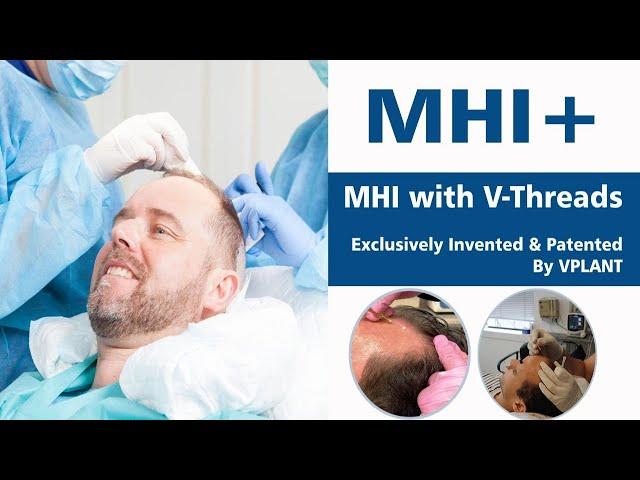 Upgraded Hair Transplant Treatment|| MHI+|| First Time in India