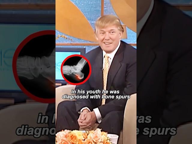 What happened to Trump’s feet#youtubeshorts #shorts #celebrity #trump