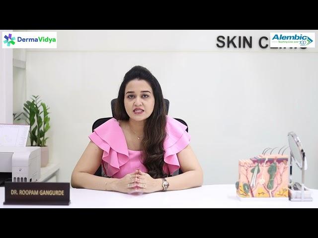 Melasma | Dr Roopam Gangurde | Nashik | DermaVidya