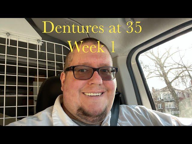 Week 1 with immediate dentures after 24 teeth extracted. Dentures at 35