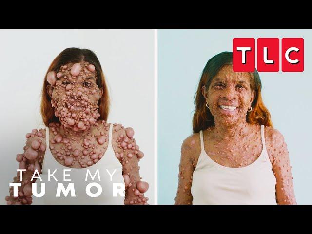 Charmaine's Life-Altering Transformation | Take My Tumor | TLC