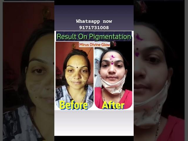 Mirus_divine_Glow cream #dark_spots #pigmentation #skinglow #face #skincare #skincareroutine  #tan