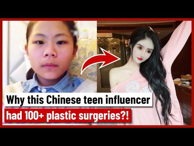 Why this Chinese teen influencer had 100+ plastic surgeries?!